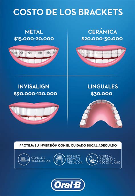 cuanto cobran por poner brackets